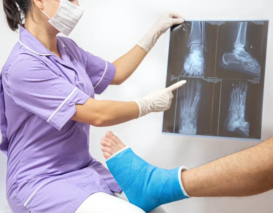 Bone Fracture Treatment